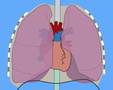 Triage en het vrouwenhart